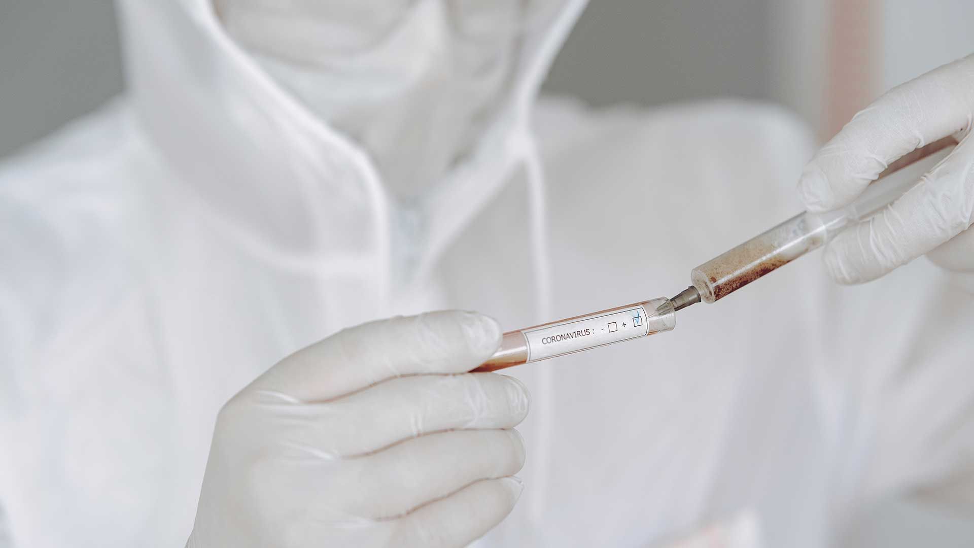 Técnico de laboratorio