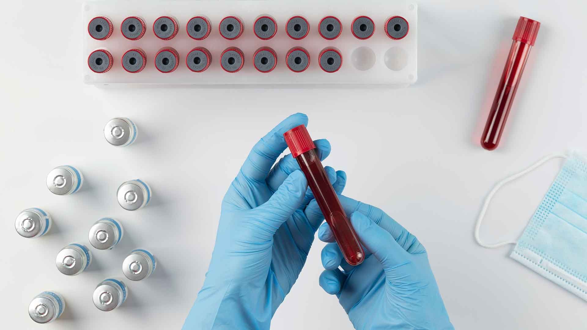 Muestras de sangre en manos de un técnico