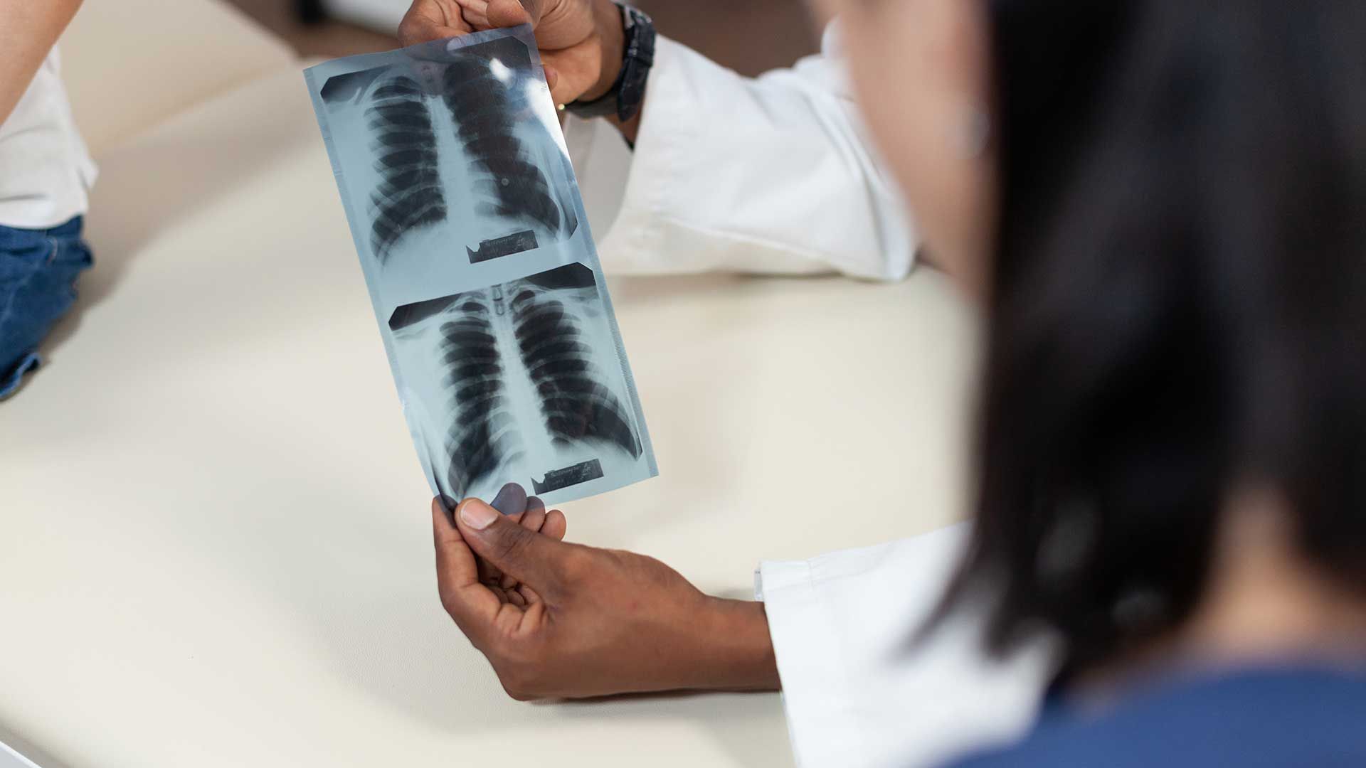 Médico mostrando radiografía pulmonar a un paciente