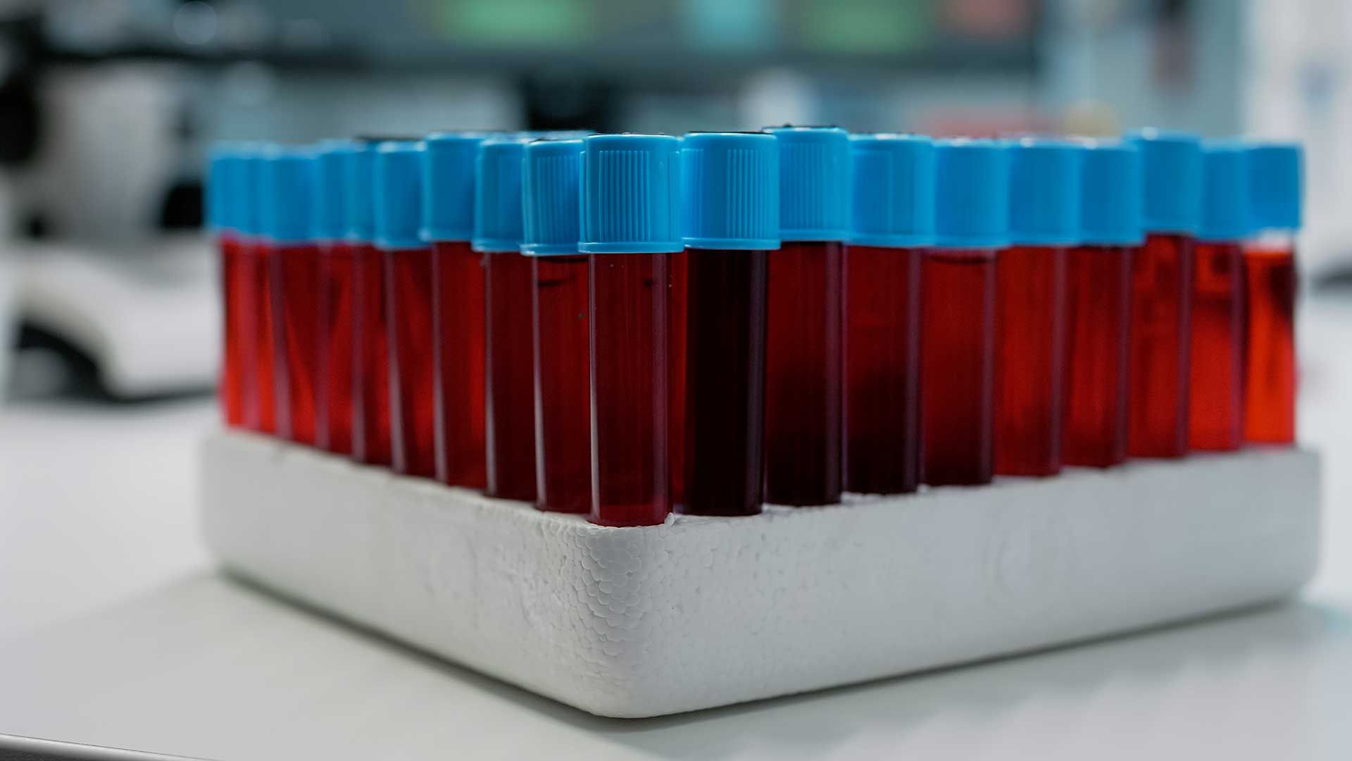Tubos con muestras de sangre