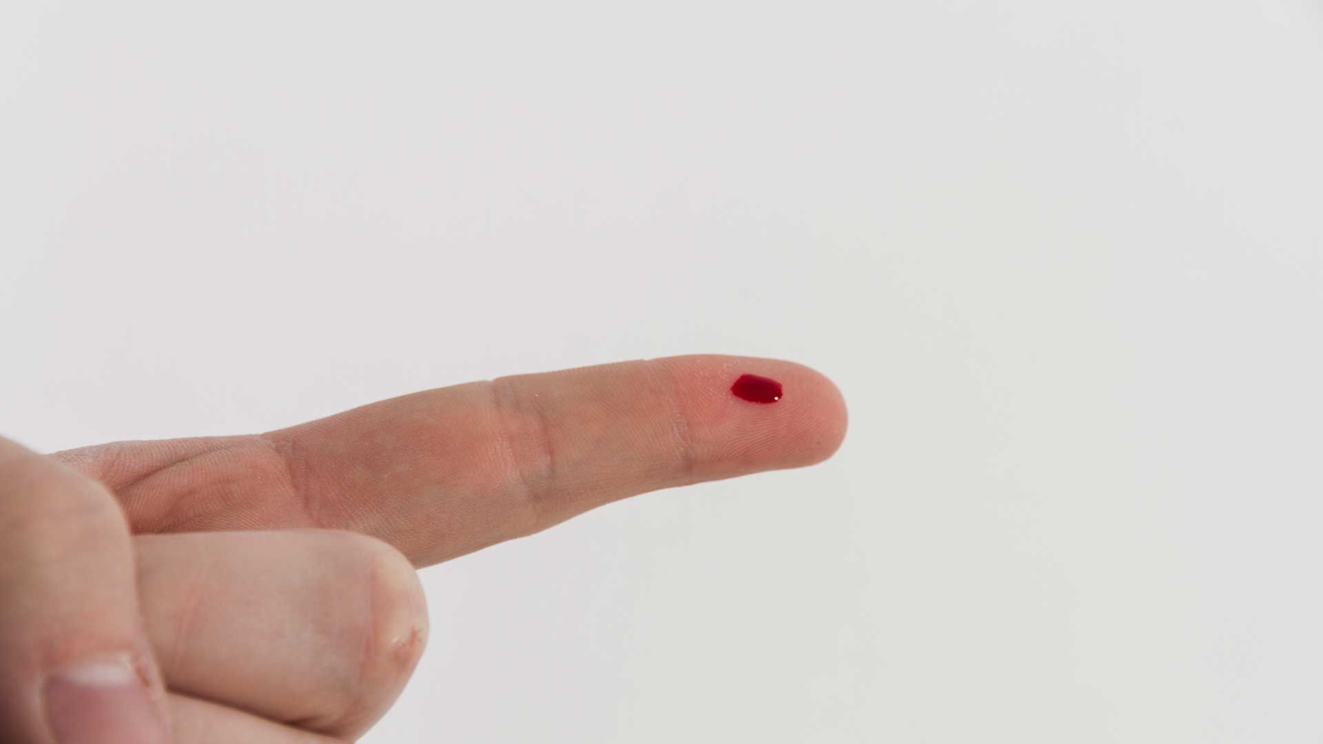 Muestra de sangre