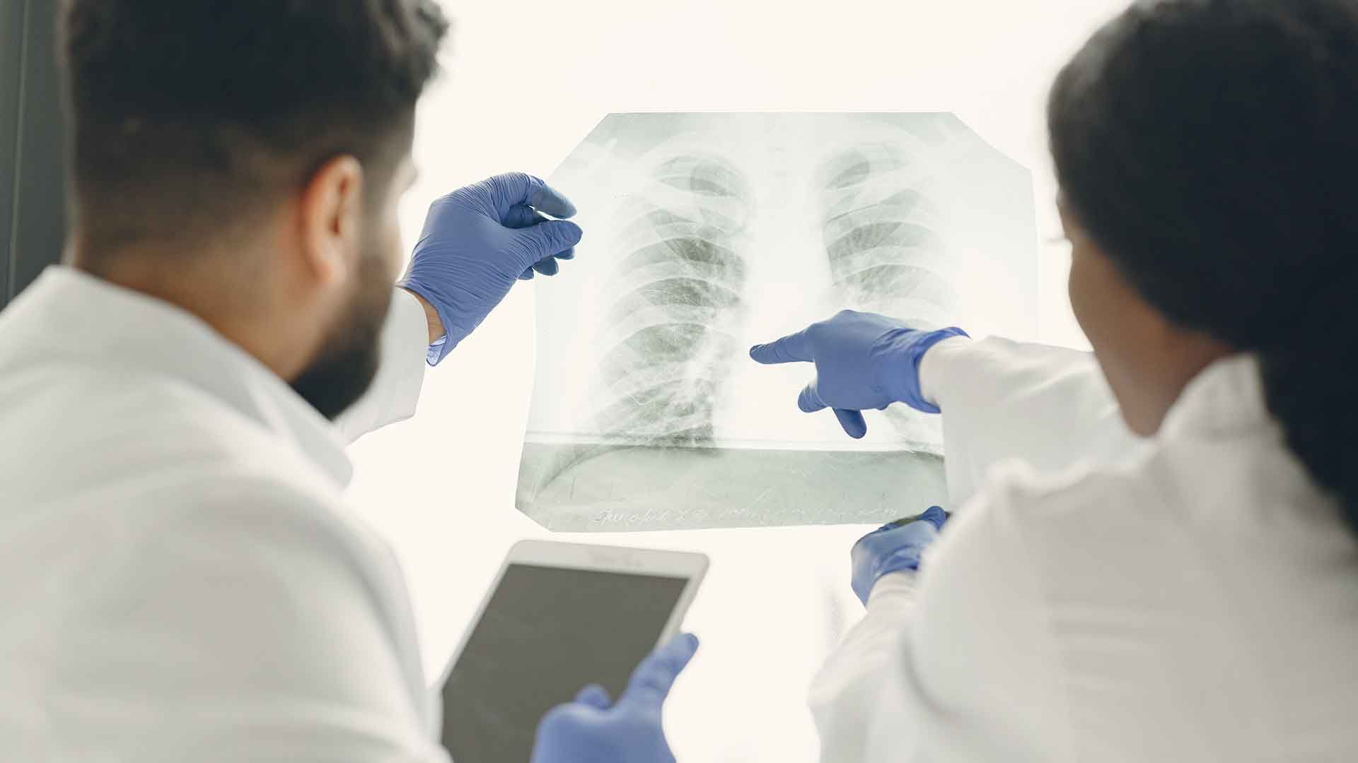 Médico con holograma de pulmones