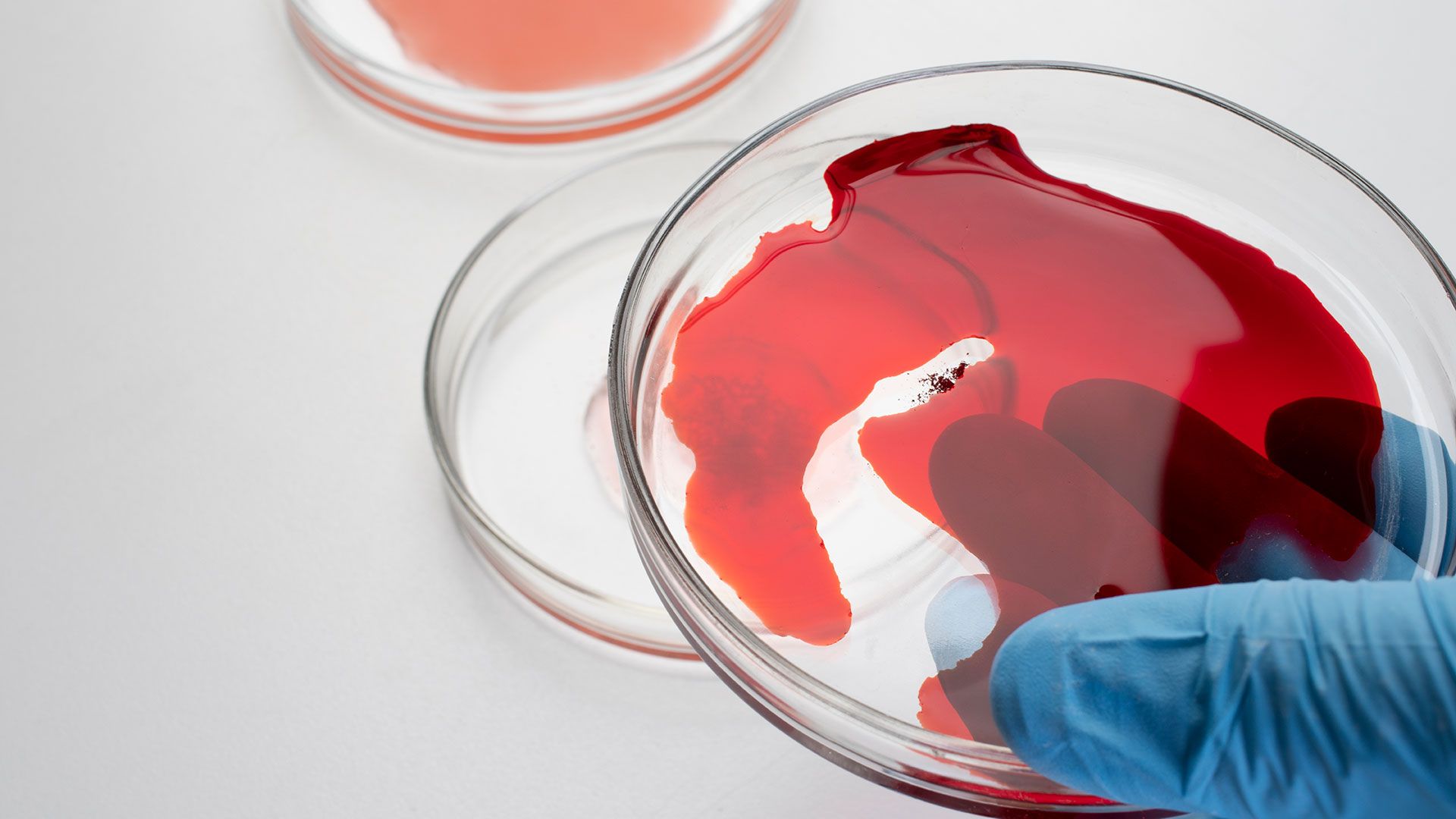 Placa de Petri con sangre