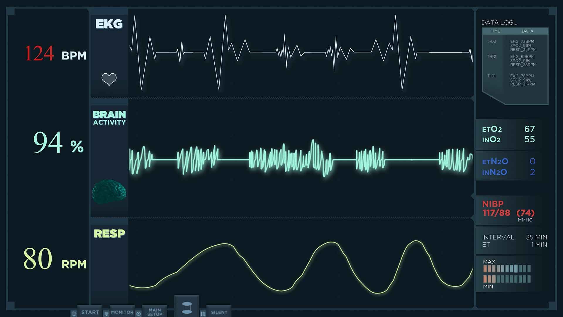 Electrocardiograma