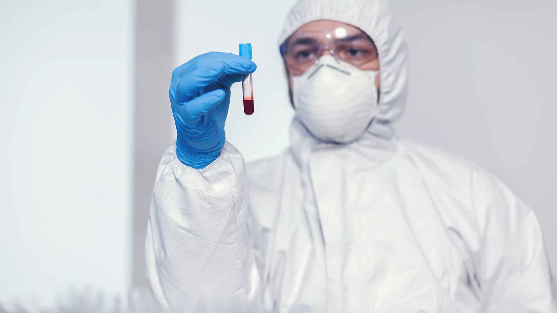 Técnico con tubo lleno de sangre