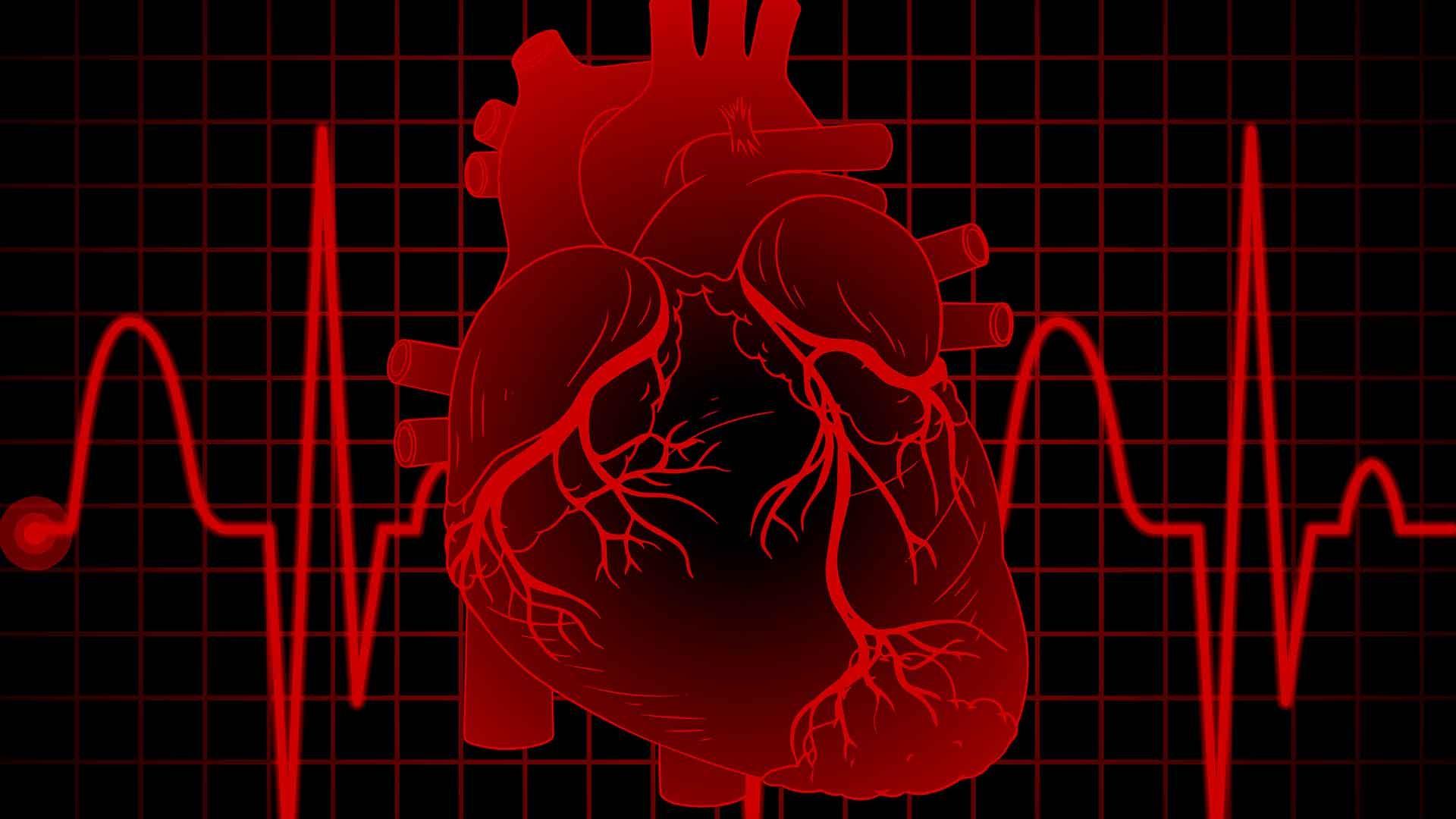 Electrocardiograma