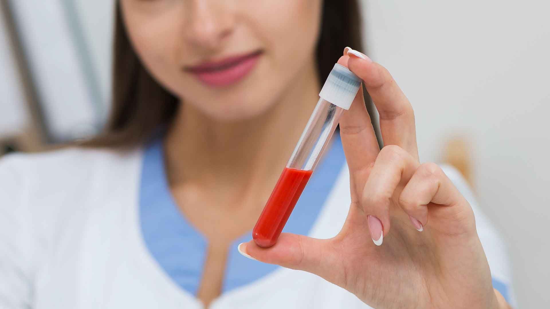 Enfermera con tubo lleno de sangre